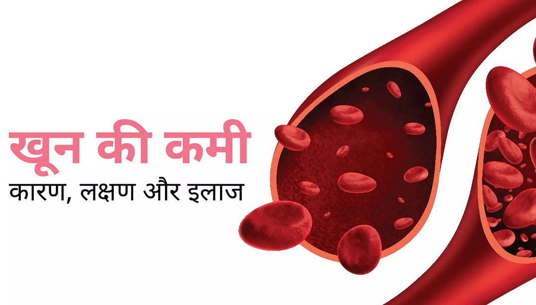 एनीमिया खून की कमी और स्वास्थ्य जांच